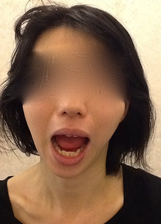 顎関節症の整体コース 公式 東京都中央区の整体院ピーク銀座のホームページ