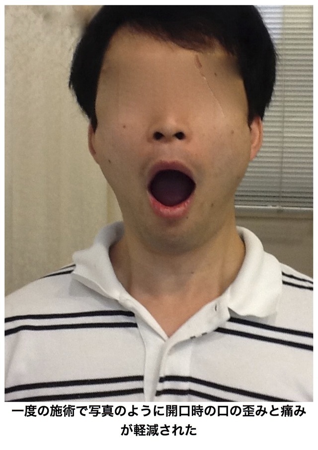 顎関節症の整体コース 公式 東京都中央区の整体院ピーク銀座のホームページ